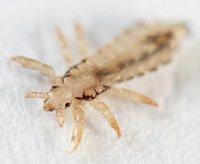 Head Lice Picture - Closeup - Symptoms of Head Lice - NitWits