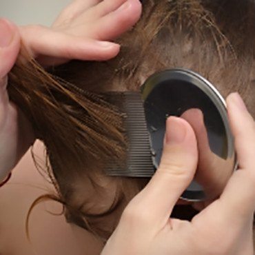Head Lice Removal - How to Remove Nits - Comb