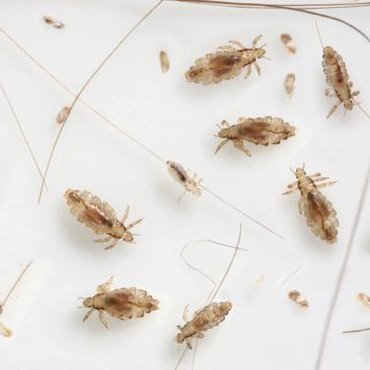 Head Lice - An extraordinary infestation